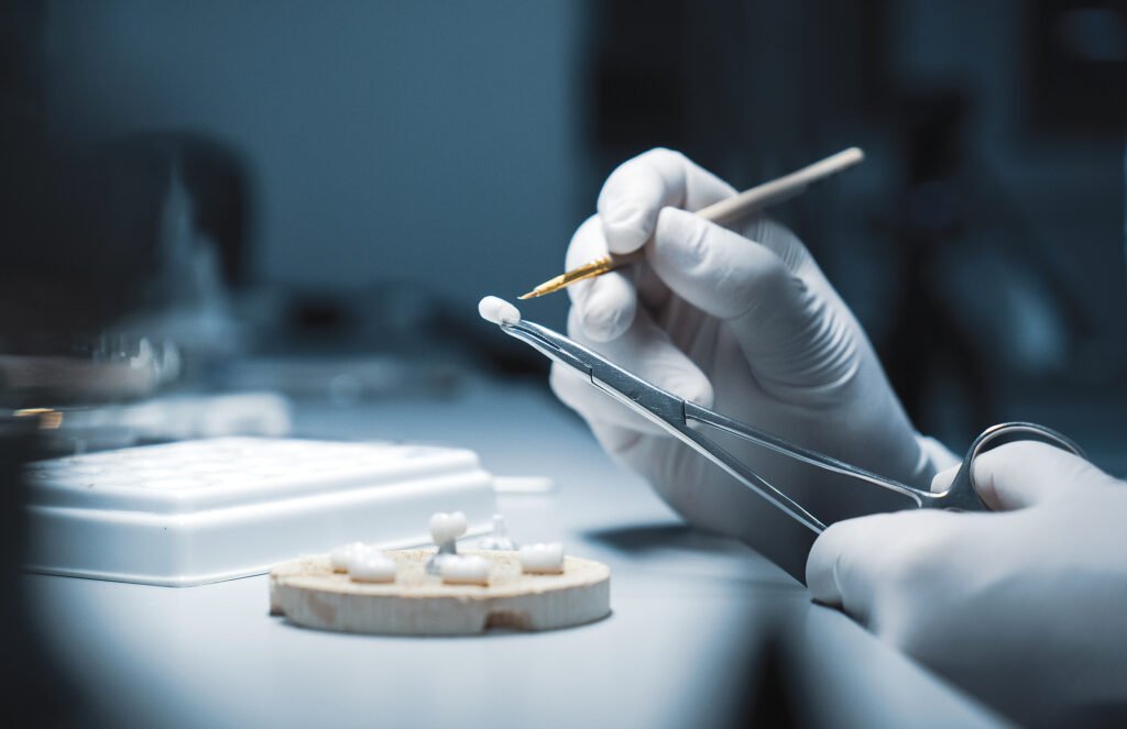 Dental crown Oldham clinic